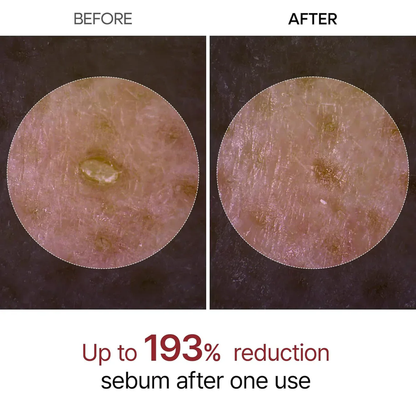 Dr.Melaxin - Rice Peel Shot Ampoule